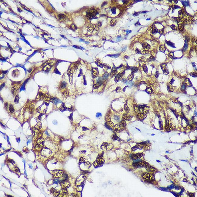 TSN Antibody in Immunohistochemistry (Paraffin) (IHC (P))