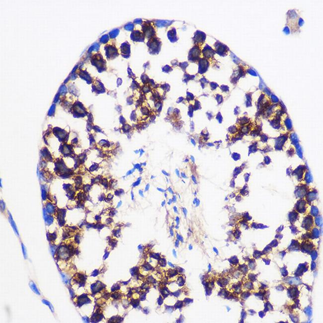 PTGES Antibody in Immunohistochemistry (Paraffin) (IHC (P))