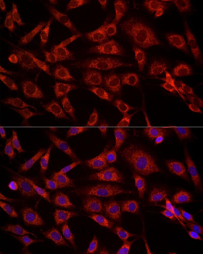 VDAC2 Antibody in Immunocytochemistry (ICC/IF)