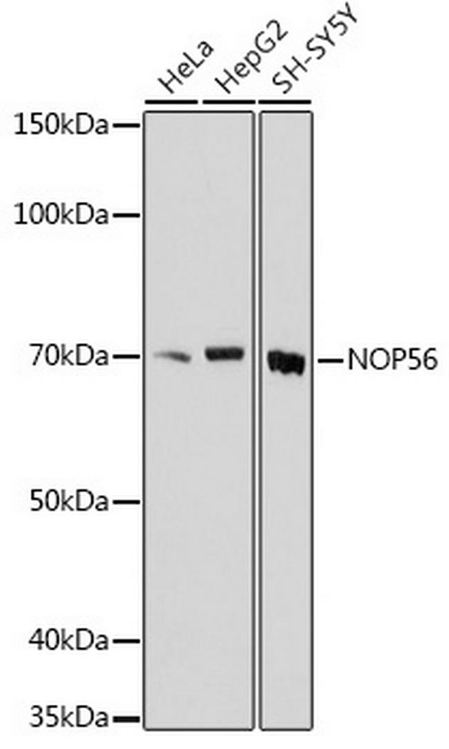 NOP56 Antibody in Western Blot (WB)