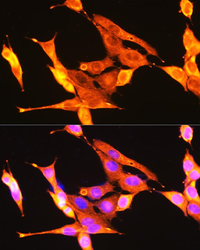 TrkA/TrkB/TrkC Antibody in Immunocytochemistry (ICC/IF)