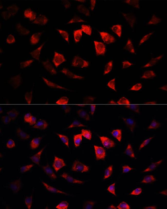 IGFBP4 Antibody in Immunocytochemistry (ICC/IF)