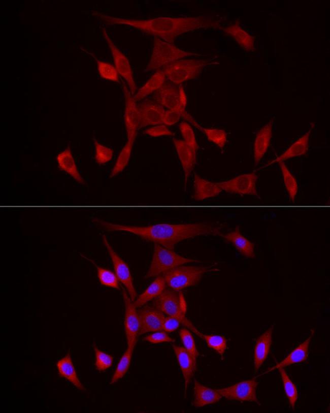 PDE4A Antibody in Immunocytochemistry (ICC/IF)