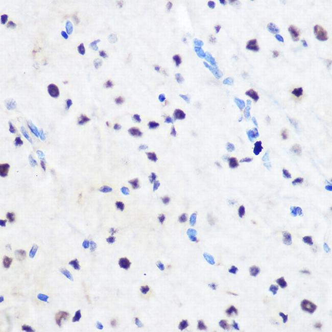 ZNF207 Antibody in Immunohistochemistry (Paraffin) (IHC (P))