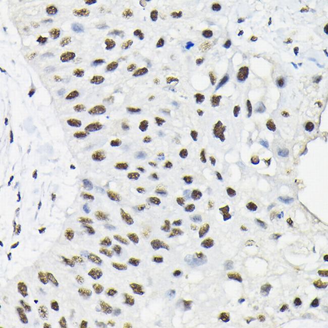 hnRNP A3 Antibody in Immunohistochemistry (Paraffin) (IHC (P))