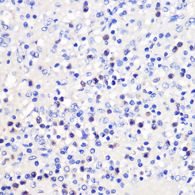 CD137 (4-1BB) Antibody in Immunohistochemistry (Paraffin) (IHC (P))