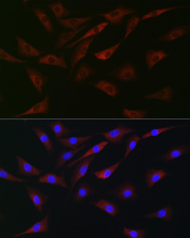 EIF4A1/EIF4A2/EIF4A3 Antibody in Immunocytochemistry (ICC/IF)