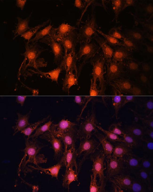 E2F1 Antibody in Immunocytochemistry (ICC/IF)