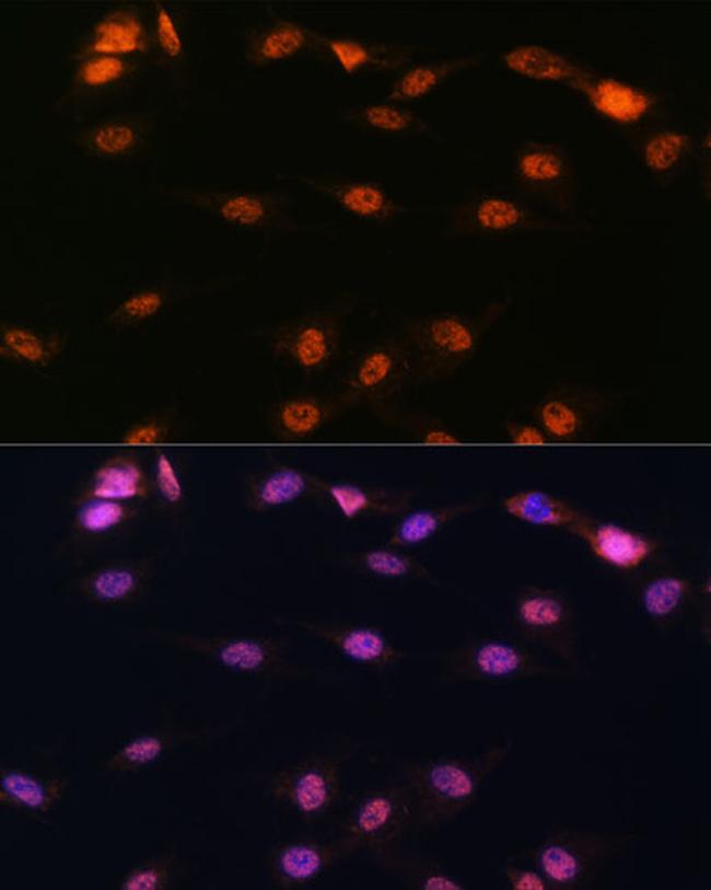 ALOX5 Antibody in Immunocytochemistry (ICC/IF)