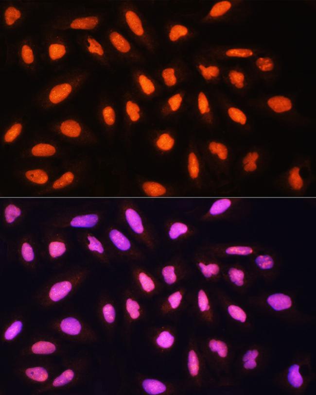 GCN5 Antibody in Immunocytochemistry (ICC/IF)