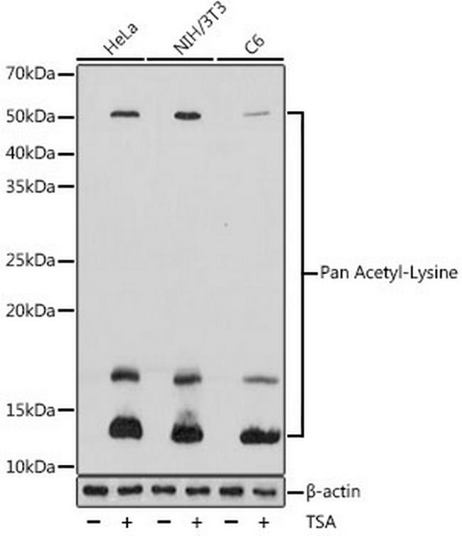 Acetylated Lysine Antibody in Western Blot (WB)