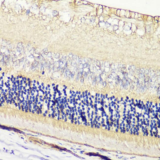 GRK1 Antibody in Immunohistochemistry (Paraffin) (IHC (P))