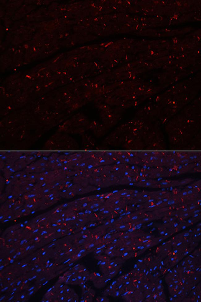 N-cadherin Antibody in Immunohistochemistry (Paraffin) (IHC (P))