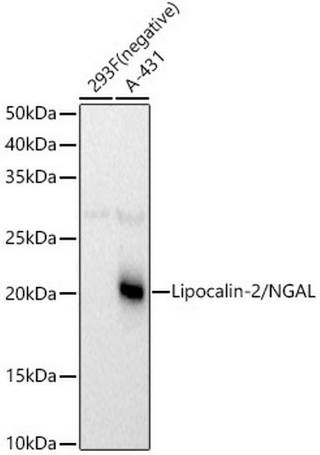 NGAL Antibody in Western Blot (WB)