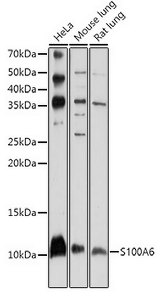 S100A6 Antibody in Western Blot (WB)