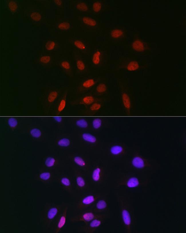 TDP1 Antibody in Immunocytochemistry (ICC/IF)