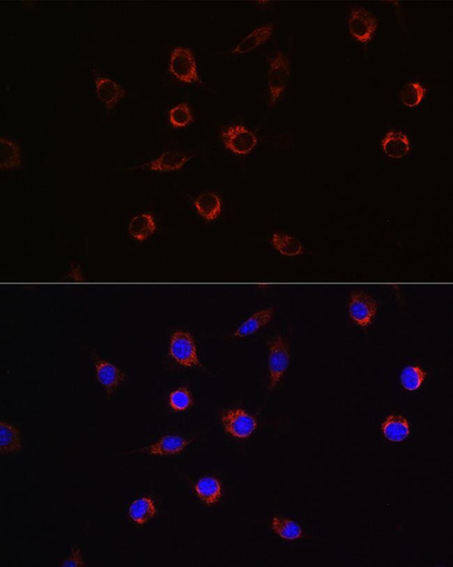 APLP2 Antibody in Immunocytochemistry (ICC/IF)