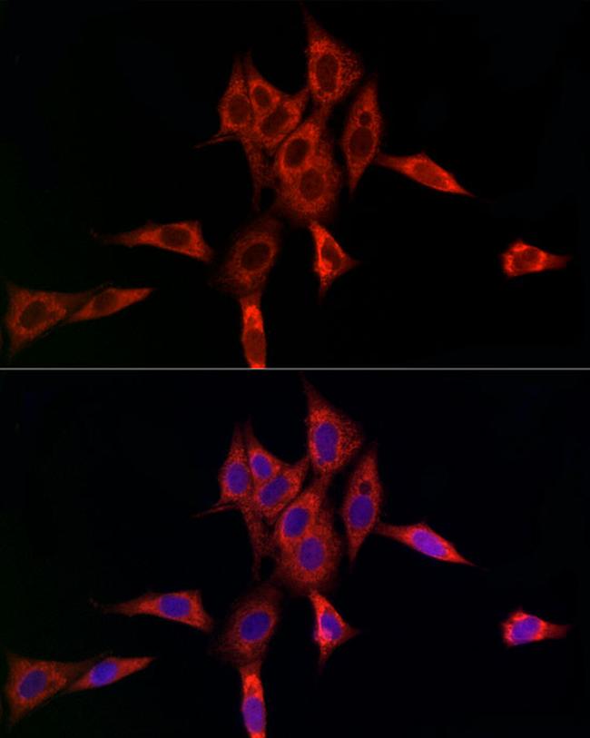 UBE2C Antibody in Immunocytochemistry (ICC/IF)