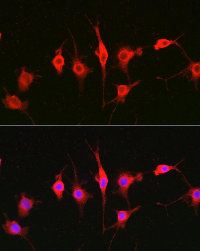 HPa1 Antibody in Immunocytochemistry (ICC/IF)