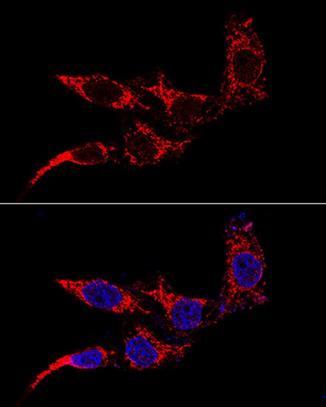 FIS1 Antibody in Immunocytochemistry (ICC/IF)