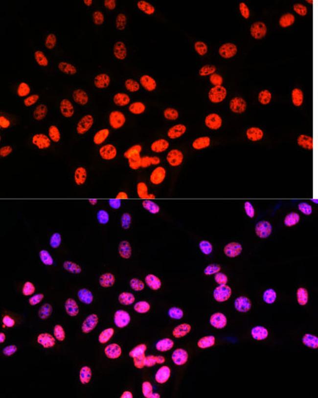 MATR3 Antibody in Immunocytochemistry (ICC/IF)