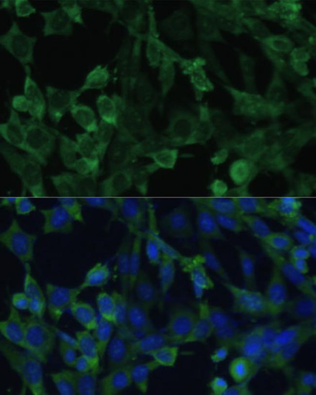 eIF1AX Antibody in Immunocytochemistry (ICC/IF)