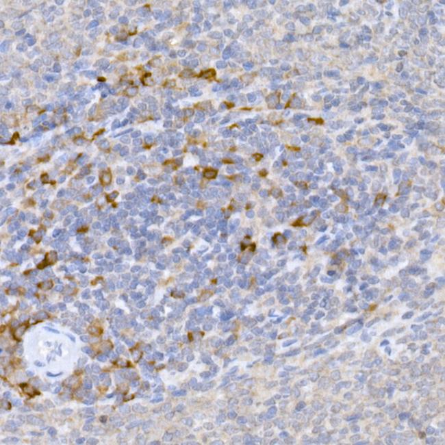 KMT2E Antibody in Immunohistochemistry (Paraffin) (IHC (P))