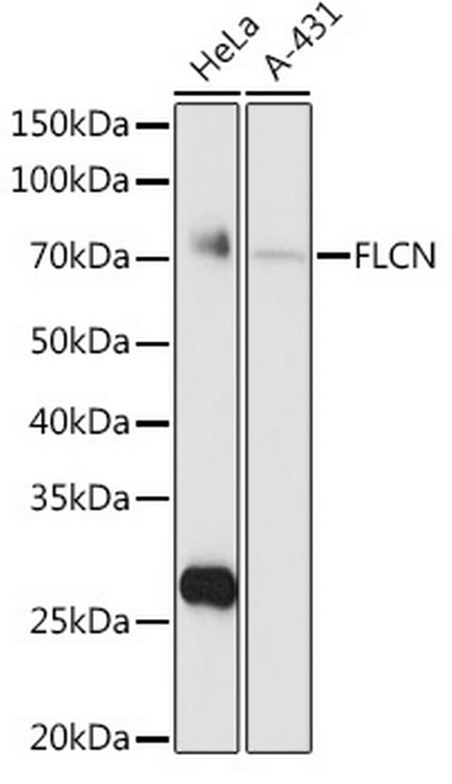 Folliculin Antibody in Western Blot (WB)