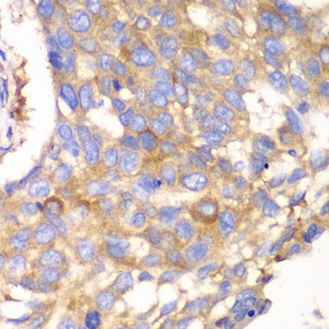 Calpain S1 Antibody in Immunohistochemistry (Paraffin) (IHC (P))