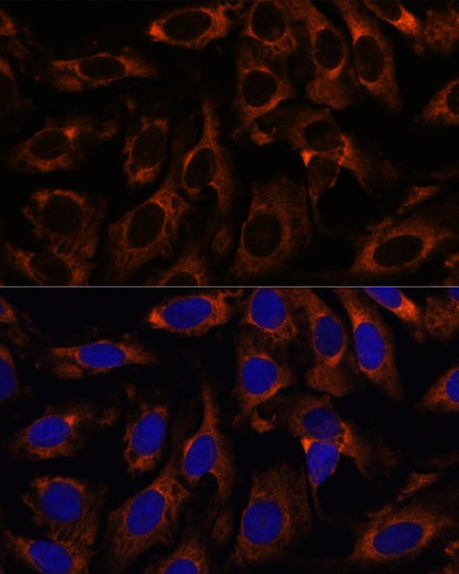 CCT3 Antibody in Immunocytochemistry (ICC/IF)