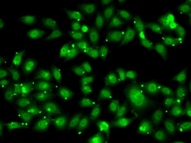 TR2 Antibody in Immunocytochemistry (ICC/IF)