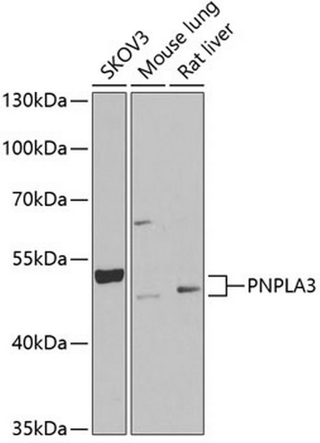 PNPLA3 Antibody in Western Blot (WB)