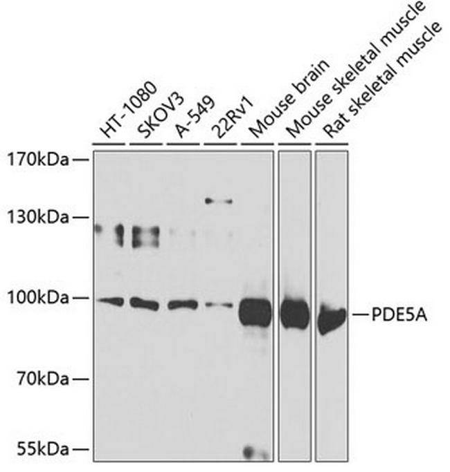 PDE5 Antibody in Western Blot (WB)