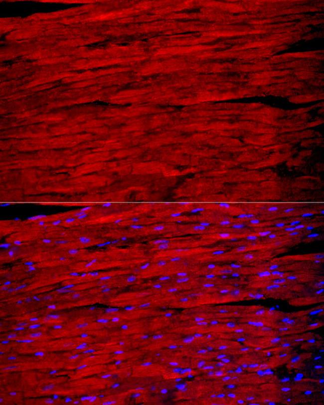 Myosin heavy chain 1 Antibody in Immunocytochemistry (ICC/IF)