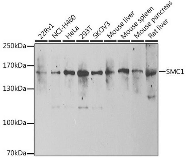 SMC1 Antibody in Western Blot (WB)