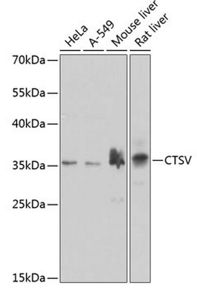 Cathepsin V Antibody in Western Blot (WB)