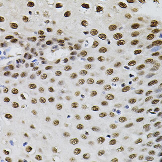 GTF2I Antibody in Immunohistochemistry (Paraffin) (IHC (P))