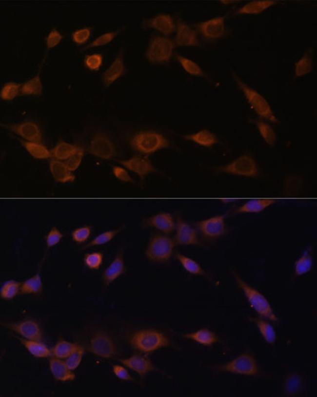 Cytochrome P450 Reductase Antibody in Immunocytochemistry (ICC/IF)