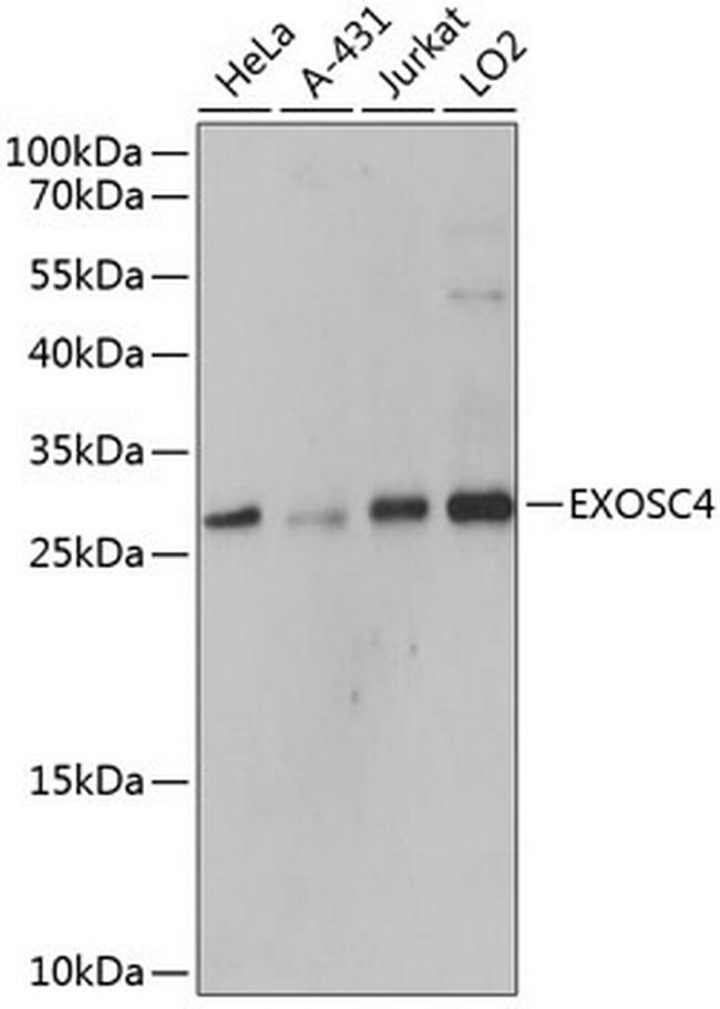 EXOSC4 Antibody in Western Blot (WB)