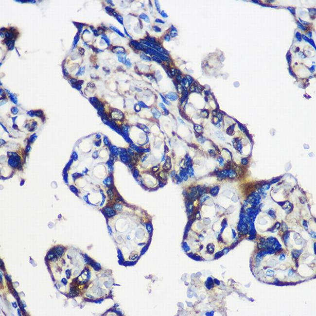 EYA1 Antibody in Immunohistochemistry (Paraffin) (IHC (P))