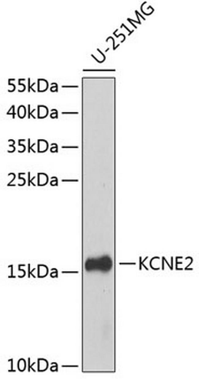 KCNE2 Antibody in Western Blot (WB)