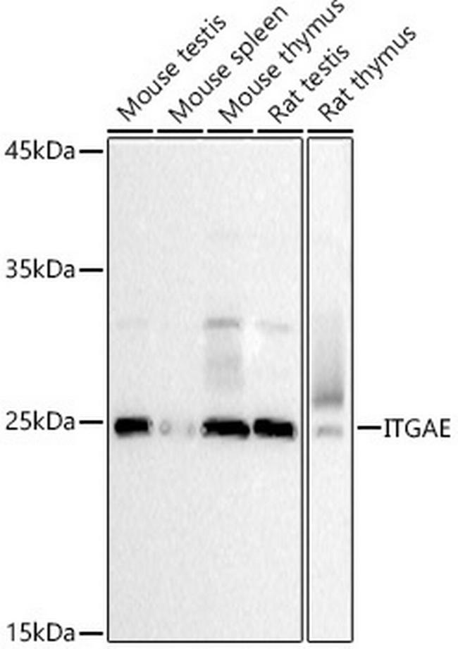 CD103 (Integrin alpha E) Antibody in Western Blot (WB)