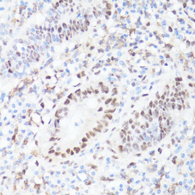 Phospho-c-Myc (Ser62) Antibody in Immunohistochemistry (Paraffin) (IHC (P))