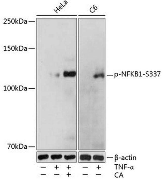 Phospho-NFkB p105/p50 (Ser337) Antibody in Western Blot (WB)