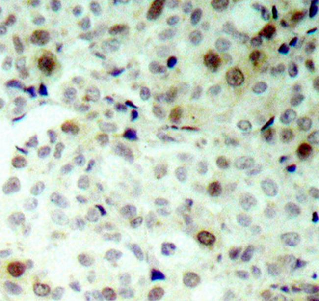 Phospho-CDK2 (Thr160) Antibody in Immunohistochemistry (Paraffin) (IHC (P))