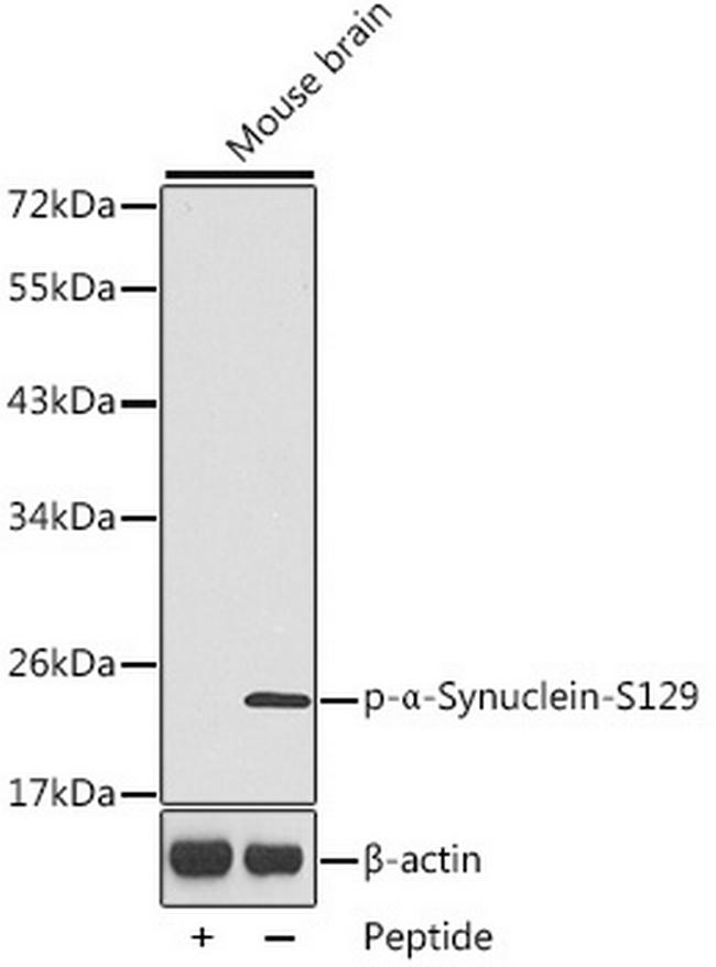 Phospho-alpha Synuclein (Ser129) Antibody in Western Blot (WB)