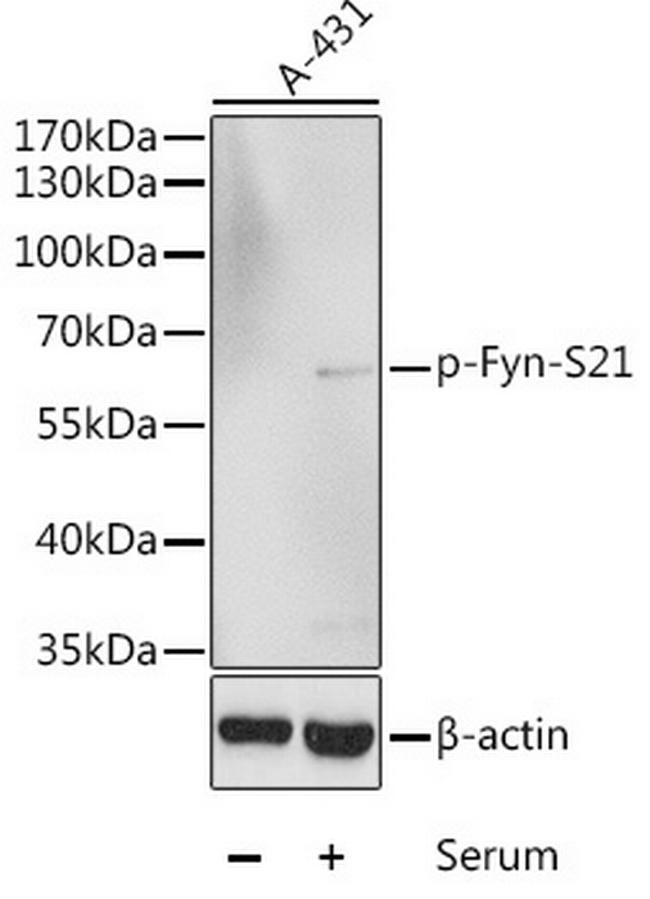 Phospho-Fyn (Ser21) Antibody in Western Blot (WB)