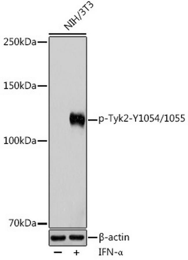 Phospho-TYK2 (Tyr1054, Tyr1055) Antibody in Western Blot (WB)