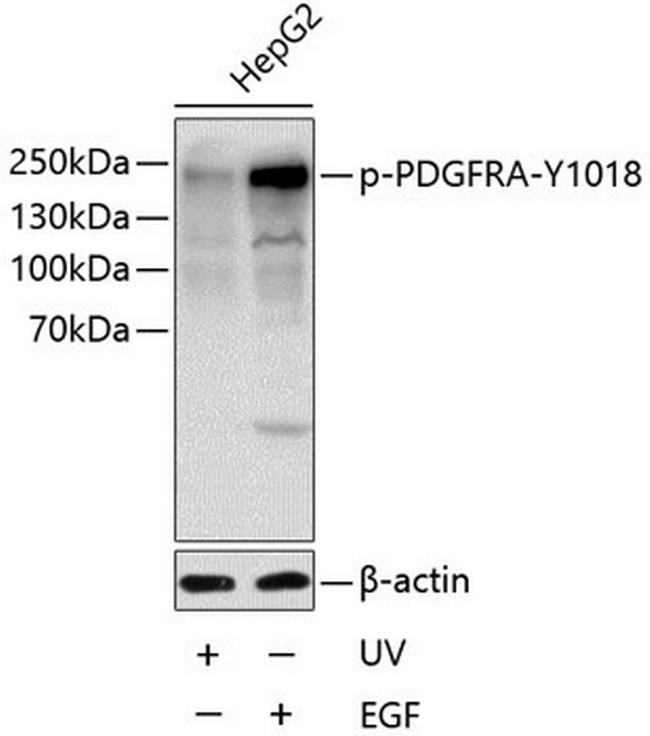 Phospho-PDGFRA (Tyr1018) Antibody in Western Blot (WB)