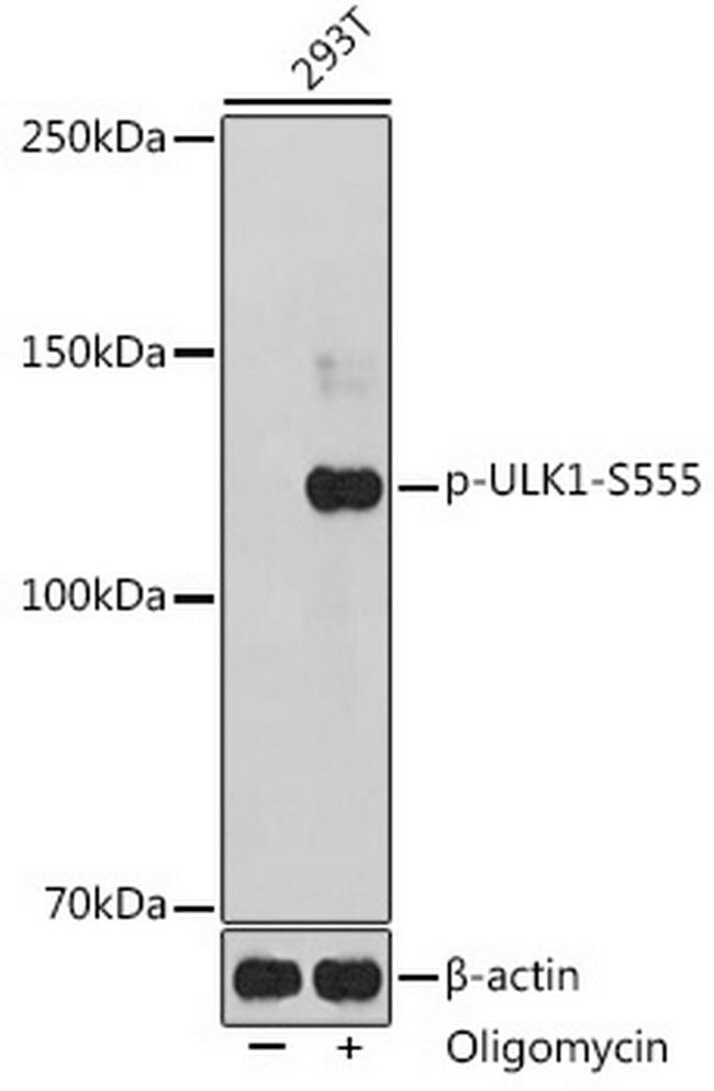 Phospho-ULK1 (Ser555) Antibody in Western Blot (WB)